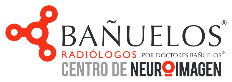 Bañuelos